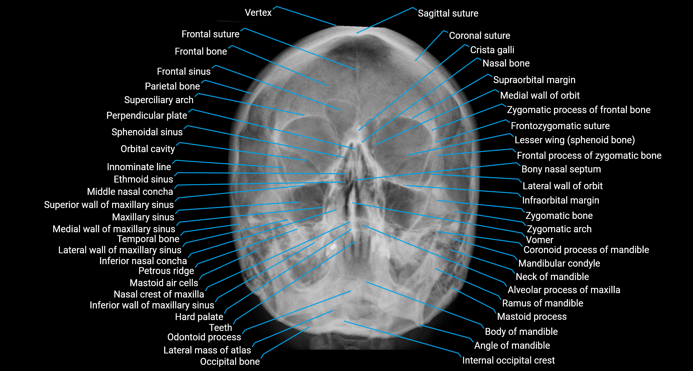 x ray facial bone  PA anatomy labelled image.png